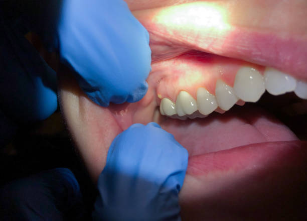 Best Urgent Dental Care for Toothaches in Richmond Hill, GA